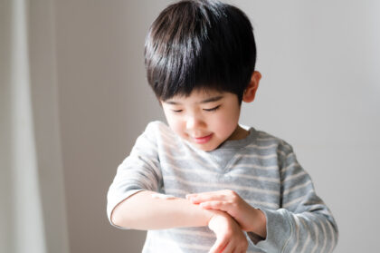 小児皮膚科